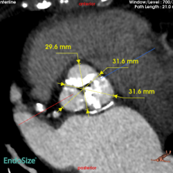 Measurements with manual adjustments displayed.