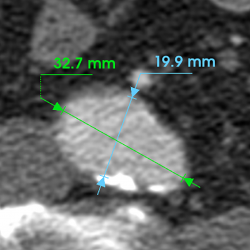 Measurements with manual adjustments displayed.